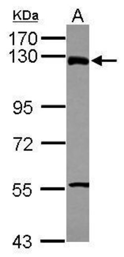 Invitrogen ZNF295 Polyclonal Antibody 100 &mu;L; Unconjugated:Antibodies,