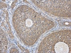 Invitrogen HEBP1 Polyclonal Antibody 100 &mu;L; Unconjugated:Antibodies,