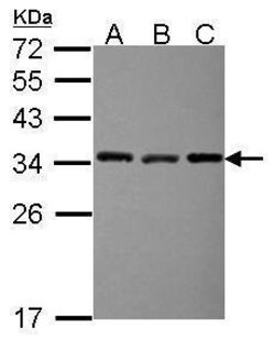 Invitrogen EXOSC3 Polyclonal Antibody 100 &mu;L; Unconjugated:Antibodies