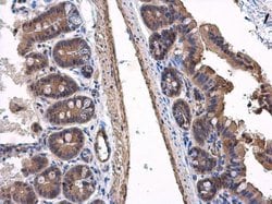 Invitrogen VPS36 Polyclonal Antibody 100 &mu;L; Unconjugated:Antibodies,