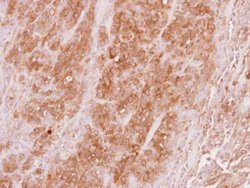 Invitrogen VPS36 Polyclonal Antibody 100 &mu;L; Unconjugated:Antibodies,