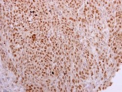 Invitrogen NOSIP Polyclonal Antibody 100 &mu;L; Unconjugated:Antibodies,