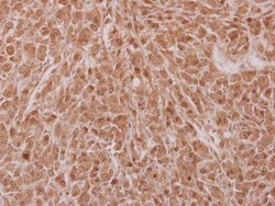 Invitrogen NOSIP Polyclonal Antibody 100 &mu;L; Unconjugated:Antibodies,