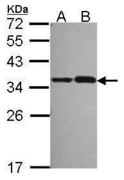 Invitrogen NOSIP Polyclonal Antibody 100 &mu;L; Unconjugated:Antibodies,