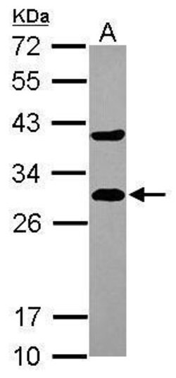 Invitrogen DCXR Polyclonal Antibody 100 &mu;L | Buy Online | Invitrogen&trade; | Fisher Scientific