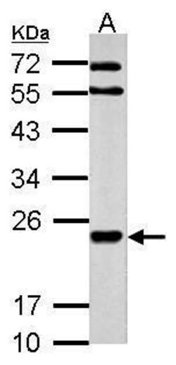 Invitrogen MARCH2 Polyclonal Antibody 100 &mu;L; Unconjugated:Antibodies,