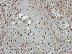 Invitrogen KLF3 Polyclonal Antibody 100 μL; Unconjugated:Antibodies,