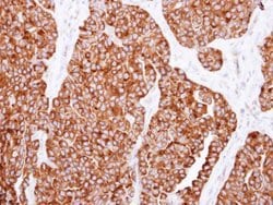 Invitrogen SNX7 Polyclonal Antibody 100 &mu;L; Unconjugated:Antibodies,