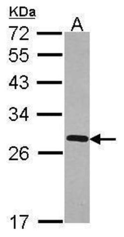 Invitrogen FKBP7 Polyclonal Antibody 100 &mu;L; Unconjugated:Antibodies,