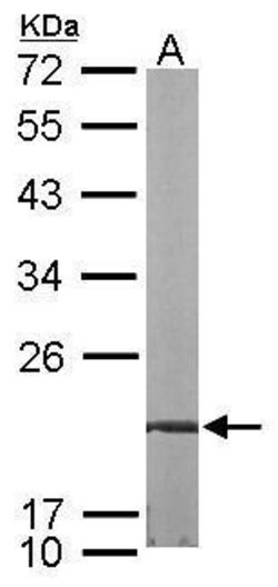 Invitrogen FKBP7 Polyclonal Antibody 100 &mu;L; Unconjugated:Antibodies,