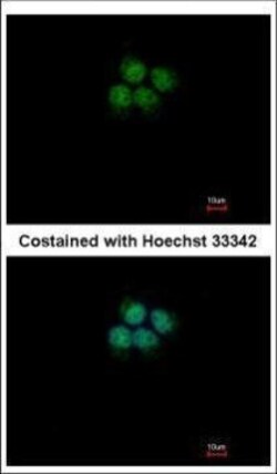 Invitrogen CPSF3 Polyclonal Antibody 100 μL; Unconjugated:Antibodies,