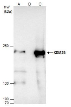 Invitrogen JMJD1B Polyclonal Antibody 100 &mu;L | Buy Online | Invitrogen&trade; | Fisher Scientific