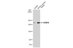 Invitrogen JMJD1B Polyclonal Antibody 100 &mu;L | Buy Online | Invitrogen&trade; | Fisher Scientific