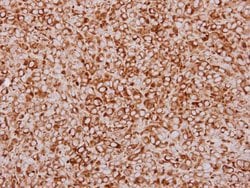 Invitrogen ZFYVE1 Polyclonal Antibody 100 &mu;L; Unconjugated:Antibodies,