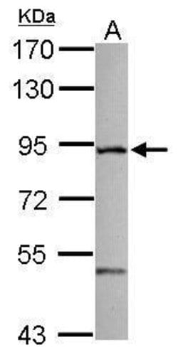 Invitrogen ZFYVE1 Polyclonal Antibody 100 &mu;L; Unconjugated:Antibodies,