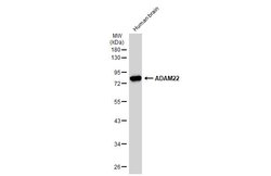 Invitrogen ADAM22 Polyclonal Antibody 100 &mu;L; Unconjugated:Antibodies,