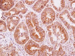 Invitrogen TRIM25 Polyclonal Antibody 100 &mu;L; Unconjugated:Antibodies,