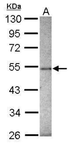 Invitrogen ZNF213 Polyclonal Antibody 100 &mu;L; Unconjugated:Antibodies,