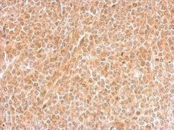 Invitrogen DNALI1 Polyclonal Antibody 100 &mu;L; Unconjugated:Antibodies,
