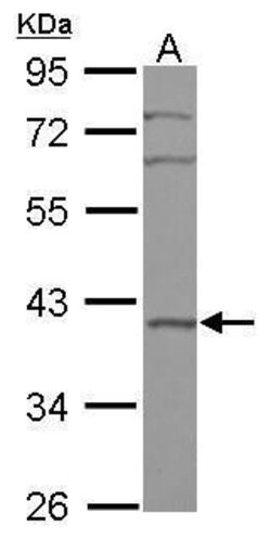 Invitrogen BXDC2 Polyclonal Antibody 100 &mu;L | Buy Online | Invitrogen&trade; | Fisher Scientific