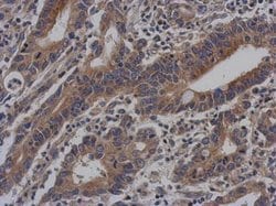 Invitrogen Vezatin Polyclonal Antibody 100 &mu;L; Unconjugated:Antibodies,