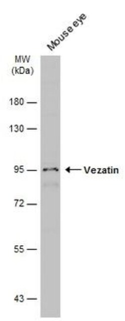 Invitrogen Vezatin Polyclonal Antibody 100 &mu;L; Unconjugated:Antibodies,
