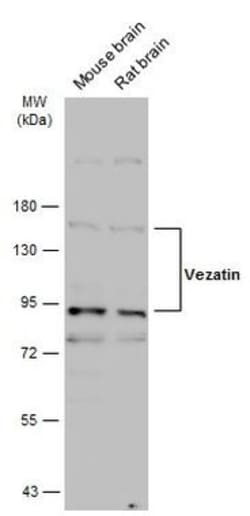 Invitrogen Vezatin Polyclonal Antibody 100 &mu;L; Unconjugated:Antibodies,