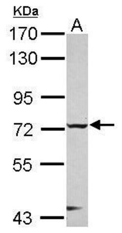 Invitrogen CHFR Polyclonal Antibody 100 &mu;L; Unconjugated:Antibodies,