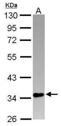 Invitrogen PINX1 Polyclonal Antibody 100 &mu;L; Unconjugated:Antibodies,