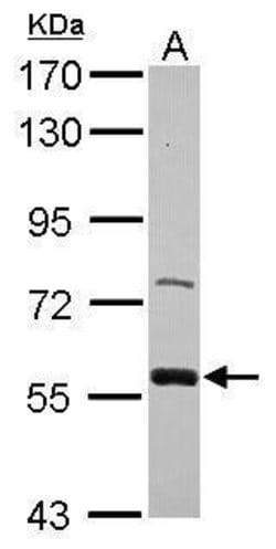 Invitrogen ZWILCH Polyclonal Antibody 100 &mu;L; Unconjugated:Antibodies,