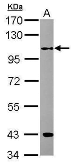 Invitrogen RFWD3 Polyclonal Antibody 100 &mu;L; Unconjugated:Antibodies,