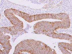 Invitrogen ATAD3A Polyclonal Antibody 100 &mu;L; Unconjugated:Antibodies,
