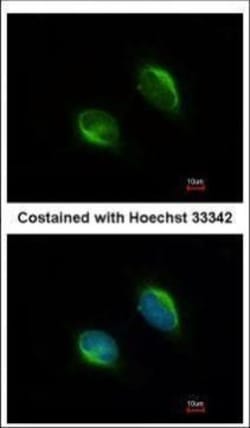 Invitrogen TYW1 Polyclonal Antibody 100 &mu;L; Unconjugated:Antibodies,