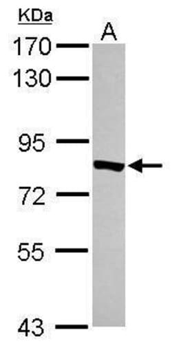 Invitrogen TYW1 Polyclonal Antibody 100 &mu;L; Unconjugated:Antibodies,