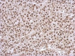 Invitrogen PHF10 Polyclonal Antibody 100 &mu;L; Unconjugated:Antibodies,
