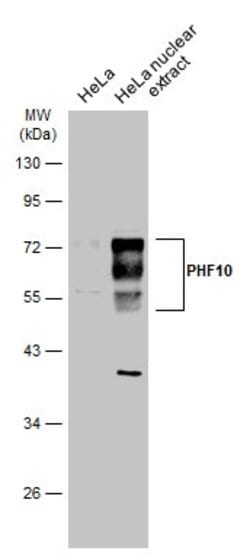 Invitrogen PHF10 Polyclonal Antibody 100 &mu;L; Unconjugated:Antibodies,