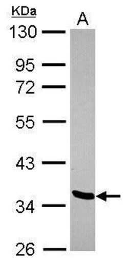 Invitrogen LDB2 Polyclonal Antibody 100 &mu;L; Unconjugated:Antibodies,