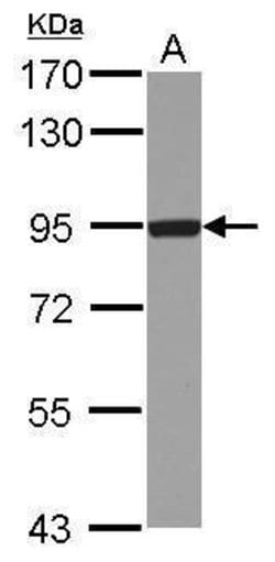 Invitrogen DTX3L Polyclonal Antibody 100 μL; Unconjugated:Antibodies,