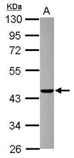 Invitrogen AGAP1 Polyclonal Antibody 100 μL; Unconjugated:Antibodies,