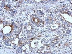 Invitrogen RAB33B Polyclonal Antibody 100 &mu;L; Unconjugated:Antibodies,