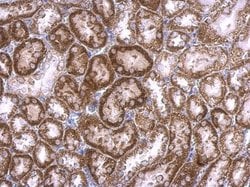 Invitrogen RAB33B Polyclonal Antibody 100 &mu;L; Unconjugated:Antibodies,