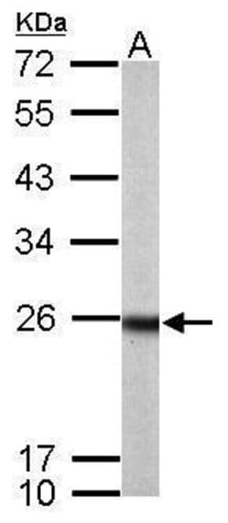 Invitrogen RAB33B Polyclonal Antibody 100 &mu;L; Unconjugated:Antibodies,