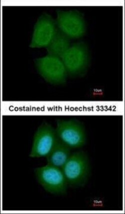 Invitrogen NXF3 Polyclonal Antibody 100 &mu;L; Unconjugated:Antibodies,