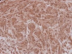Invitrogen NXF3 Polyclonal Antibody 100 &mu;L; Unconjugated:Antibodies,