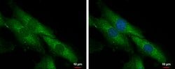 Invitrogen SLC25A23 Polyclonal Antibody 100 &mu;L; Unconjugated:Antibodies,