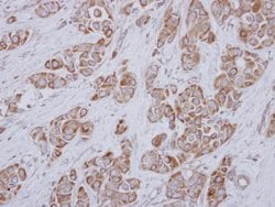 Invitrogen SLC25A23 Polyclonal Antibody 100 &mu;L; Unconjugated:Antibodies,