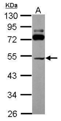 Invitrogen SLC25A23 Polyclonal Antibody 100 &mu;L; Unconjugated:Antibodies,