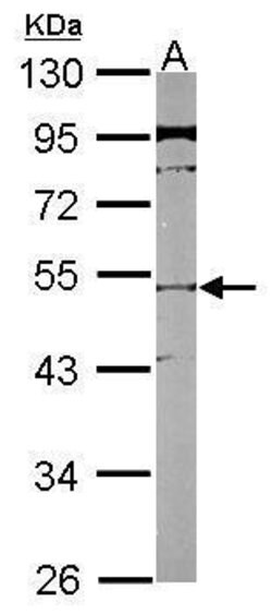 Invitrogen SLC25A23 Polyclonal Antibody 100 &mu;L; Unconjugated:Antibodies,