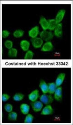 Invitrogen Galectin 1 Polyclonal Antibody 100 &mu;L; Unconjugated:Antibodies,