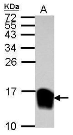 Invitrogen Galectin 1 Polyclonal Antibody 100 &mu;L; Unconjugated:Antibodies,